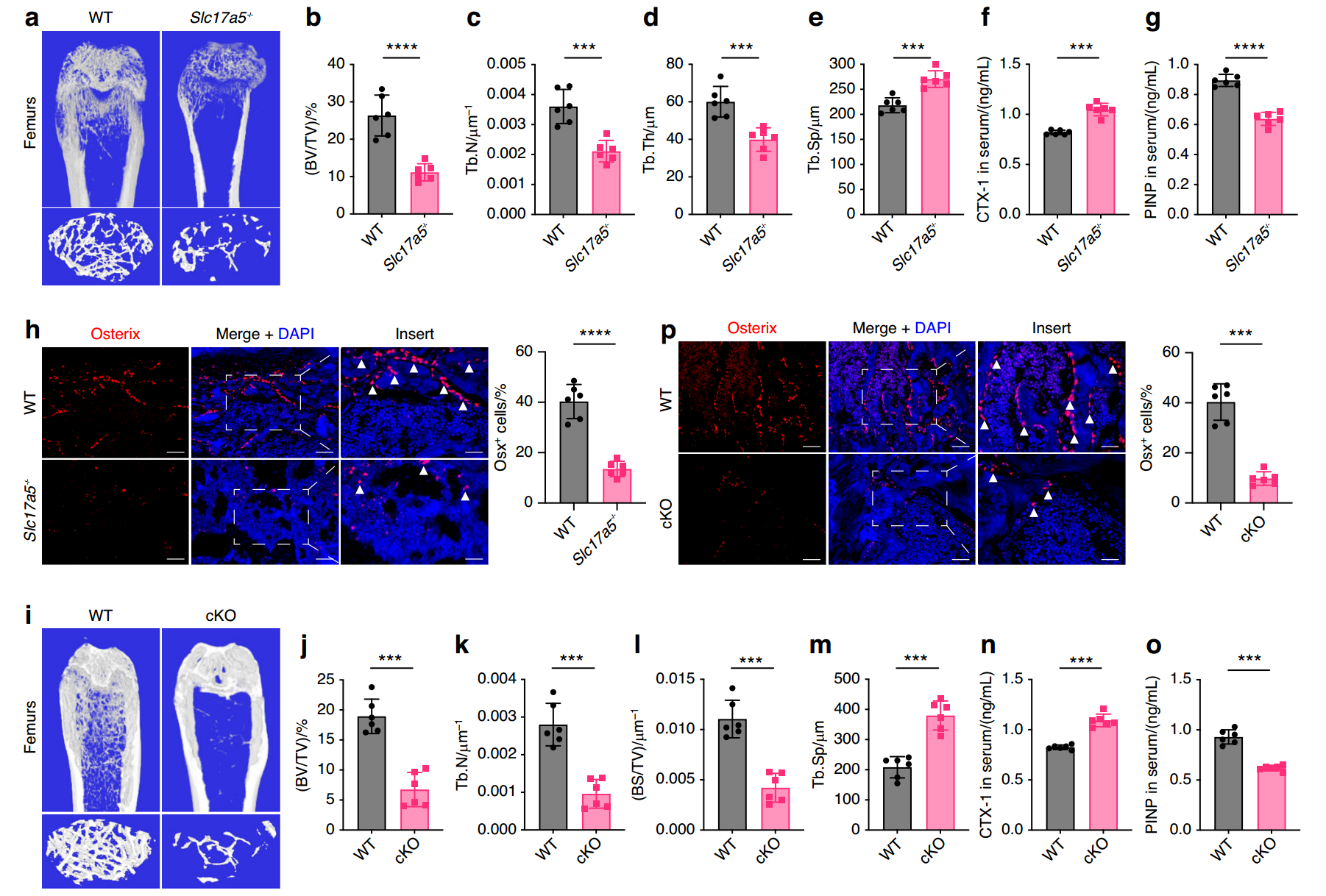 图源：Sialin-STAT3 axis regulates bone homeostasis in mice