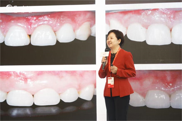 *中山大学附属口腔医院王劲茗教授