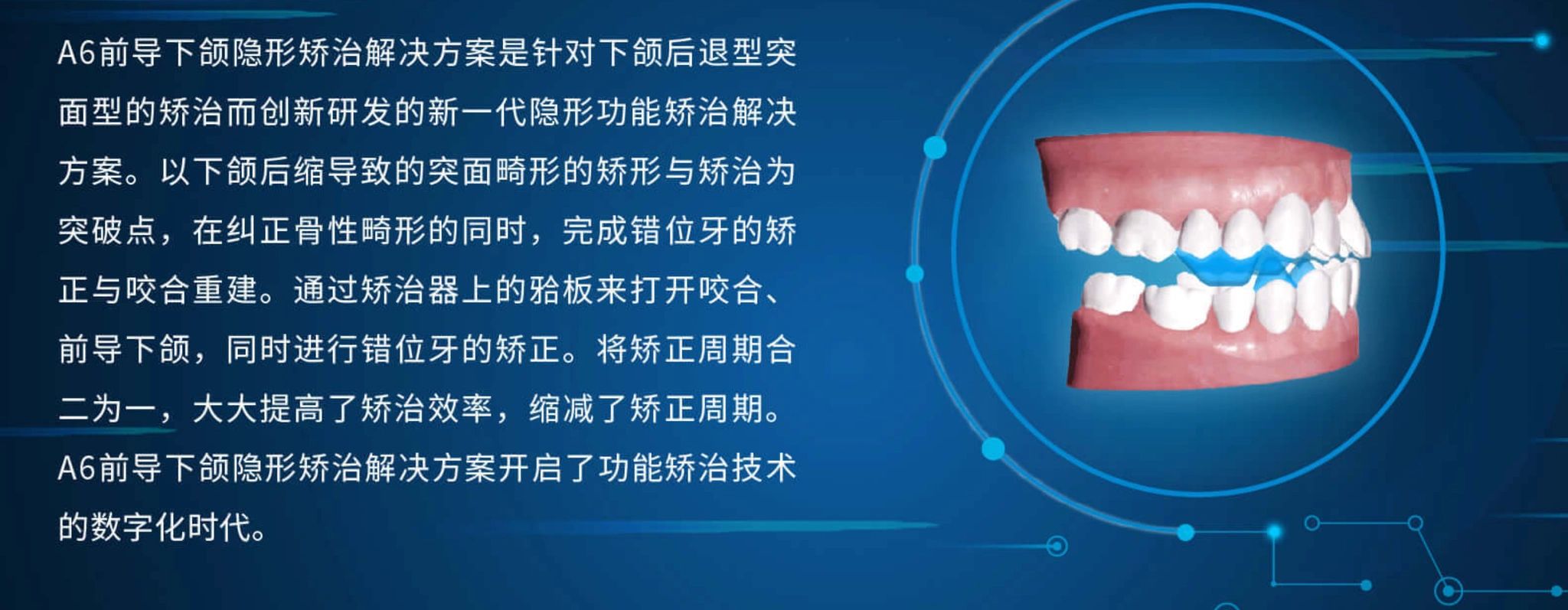 图源：时代天使官网