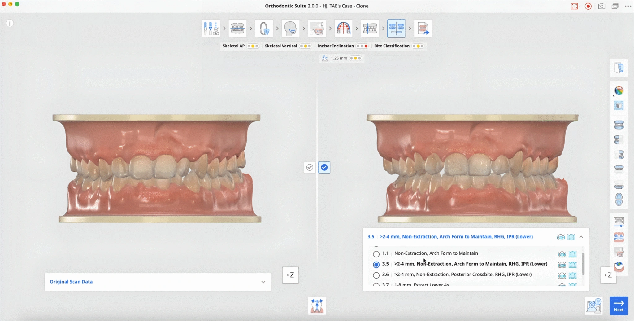 Medit Orthodontic Suite数字平台