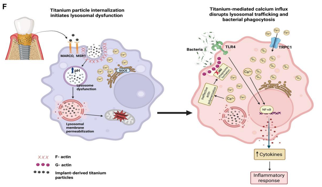 图源：《Implant-derived titanium particles impair macrophage bacterial clearance via TRPC1 and lysosomal dysfunction》