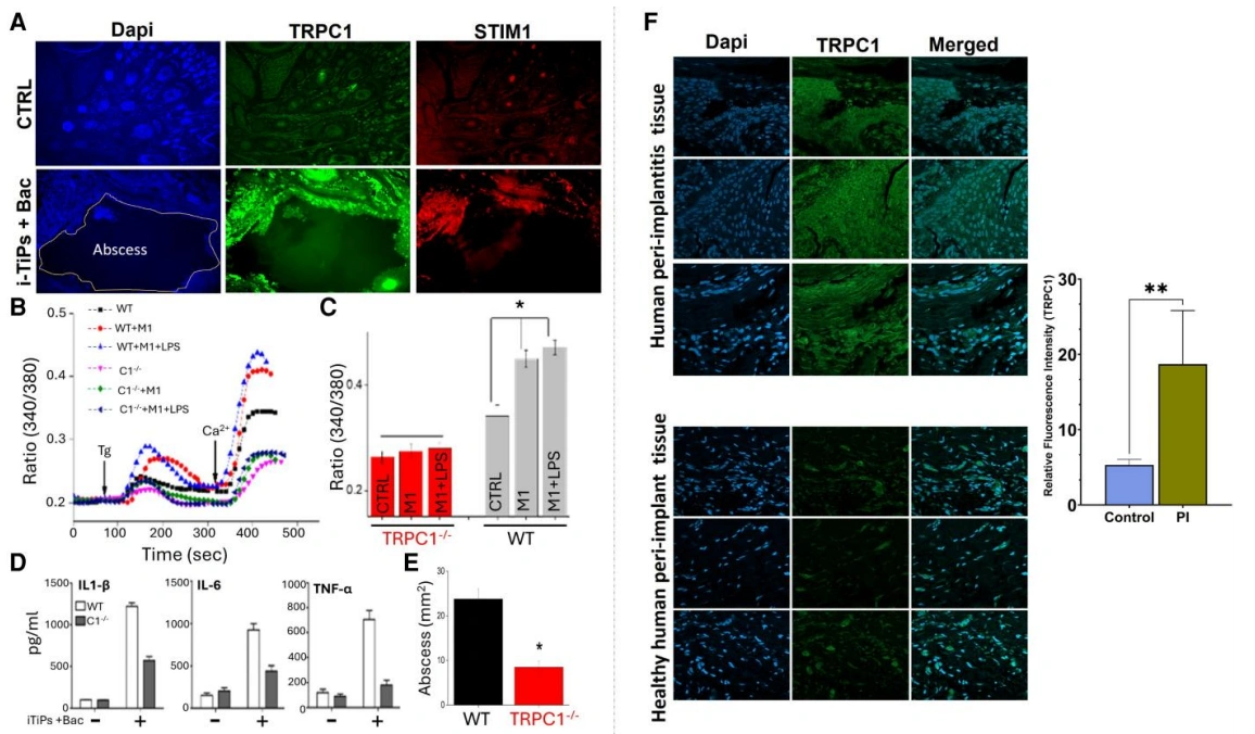 图源：《Implant-derived titanium particles impair macrophage bacterial clearance via TRPC1 and lysosomal dysfunction》