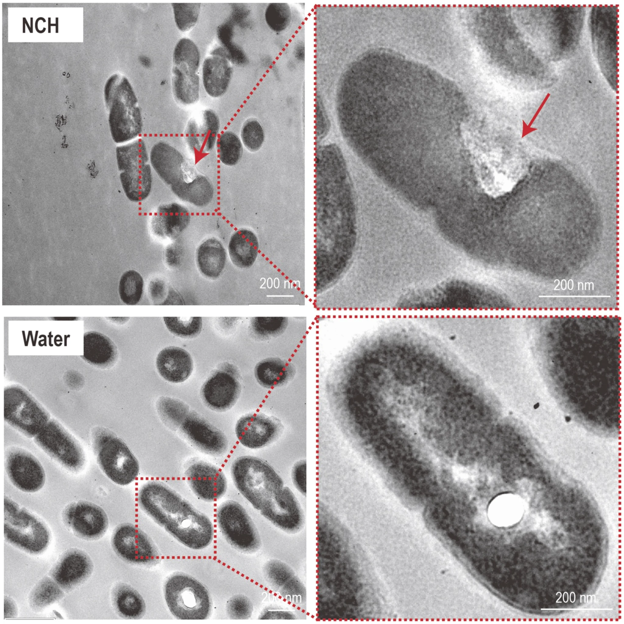 图源：Development of a novel pH-responsive anti-caries nanocomposite hydrogel