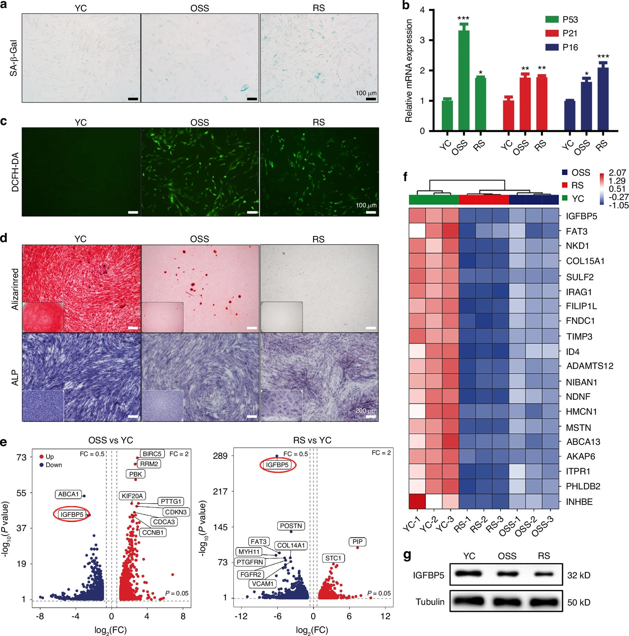 图源：IGFBP5 alleviates periodontitis by reversing human dental follicle stem cell senescence via the non-canonical Wnt pathway