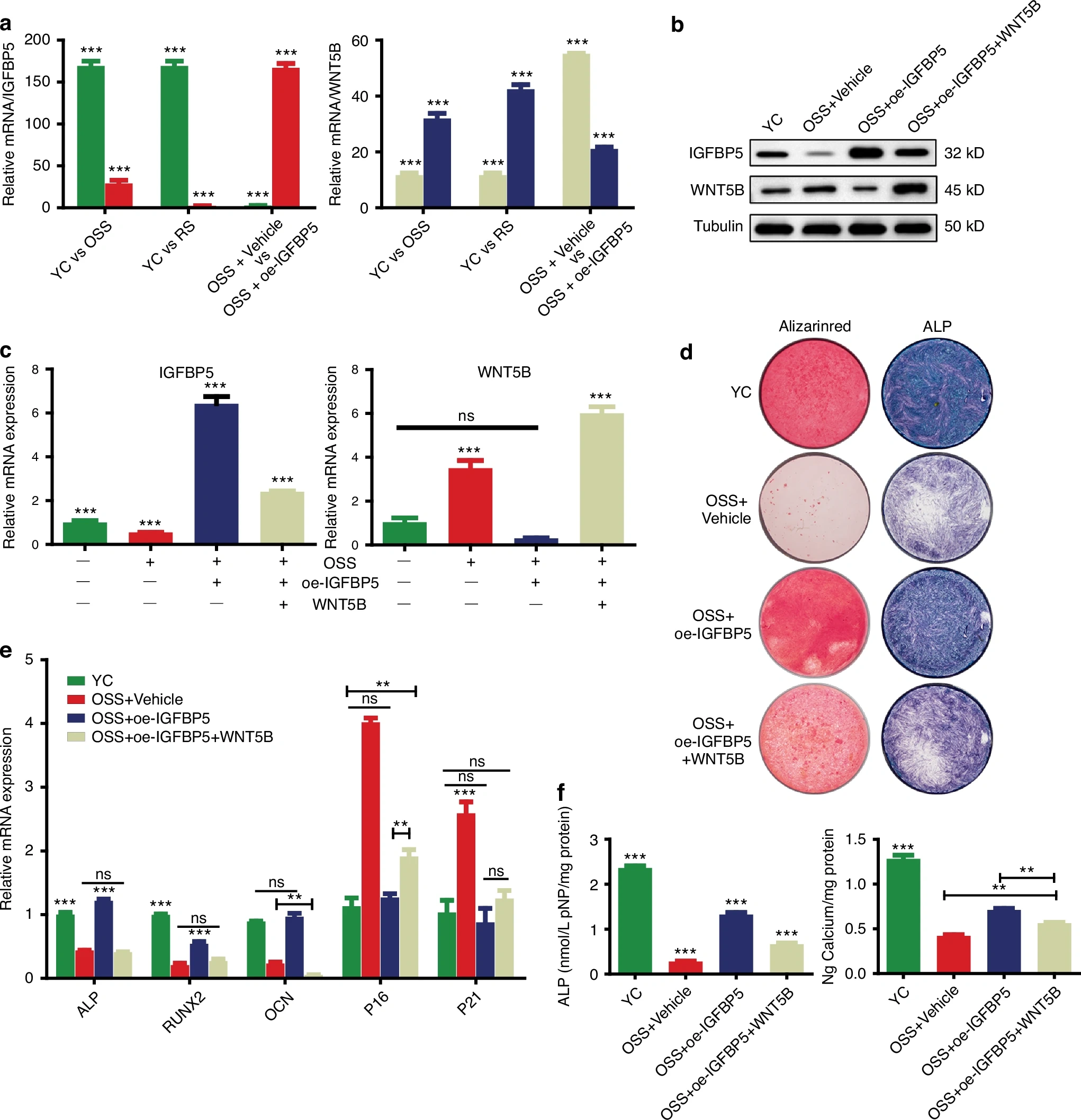 图源：IGFBP5 alleviates periodontitis by reversing human dental follicle stem cell senescence via the non-canonical Wnt pathway