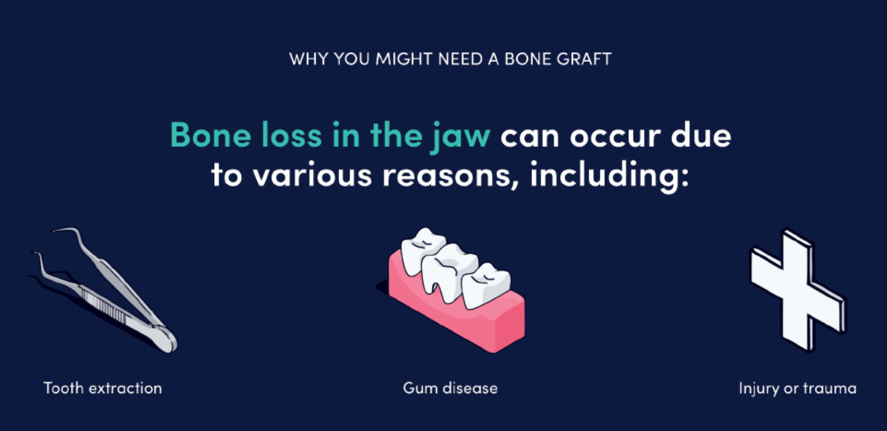 图源：《Bone Truths: What's Really In Your Smile?》