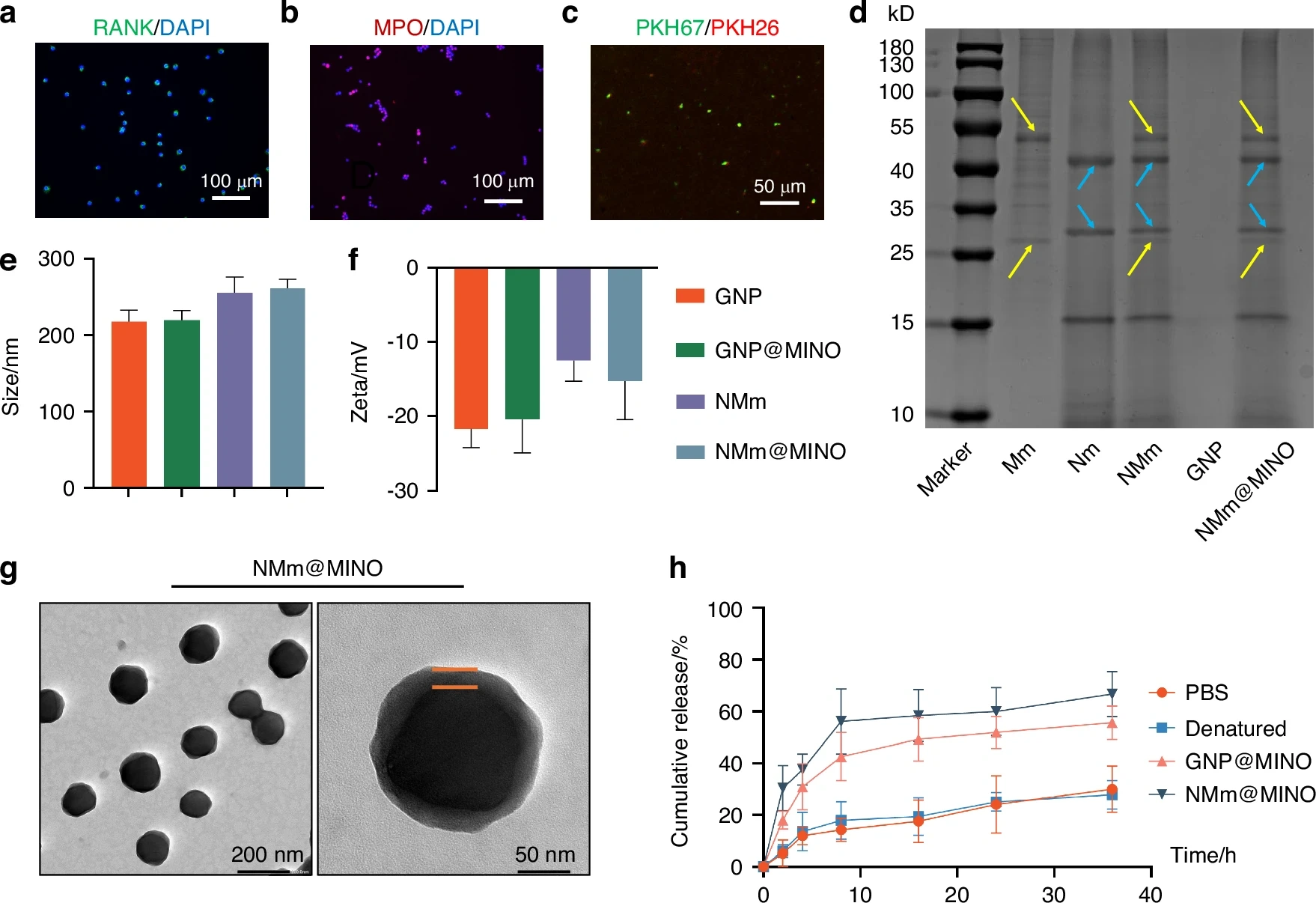 图源：A biomimetic nanoparticle coordinates antibacterial and immunomodulatory functions to promote periodontal regeneration