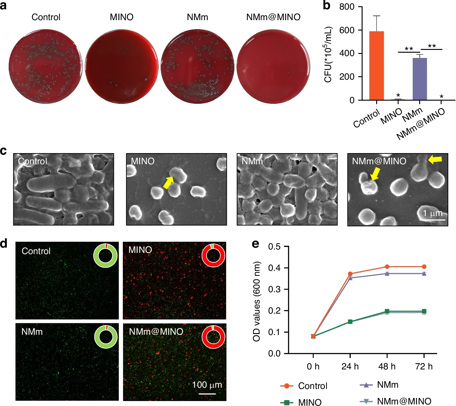 图源：A biomimetic nanoparticle coordinates antibacterial and immunomodulatory functions to promote periodontal regeneration