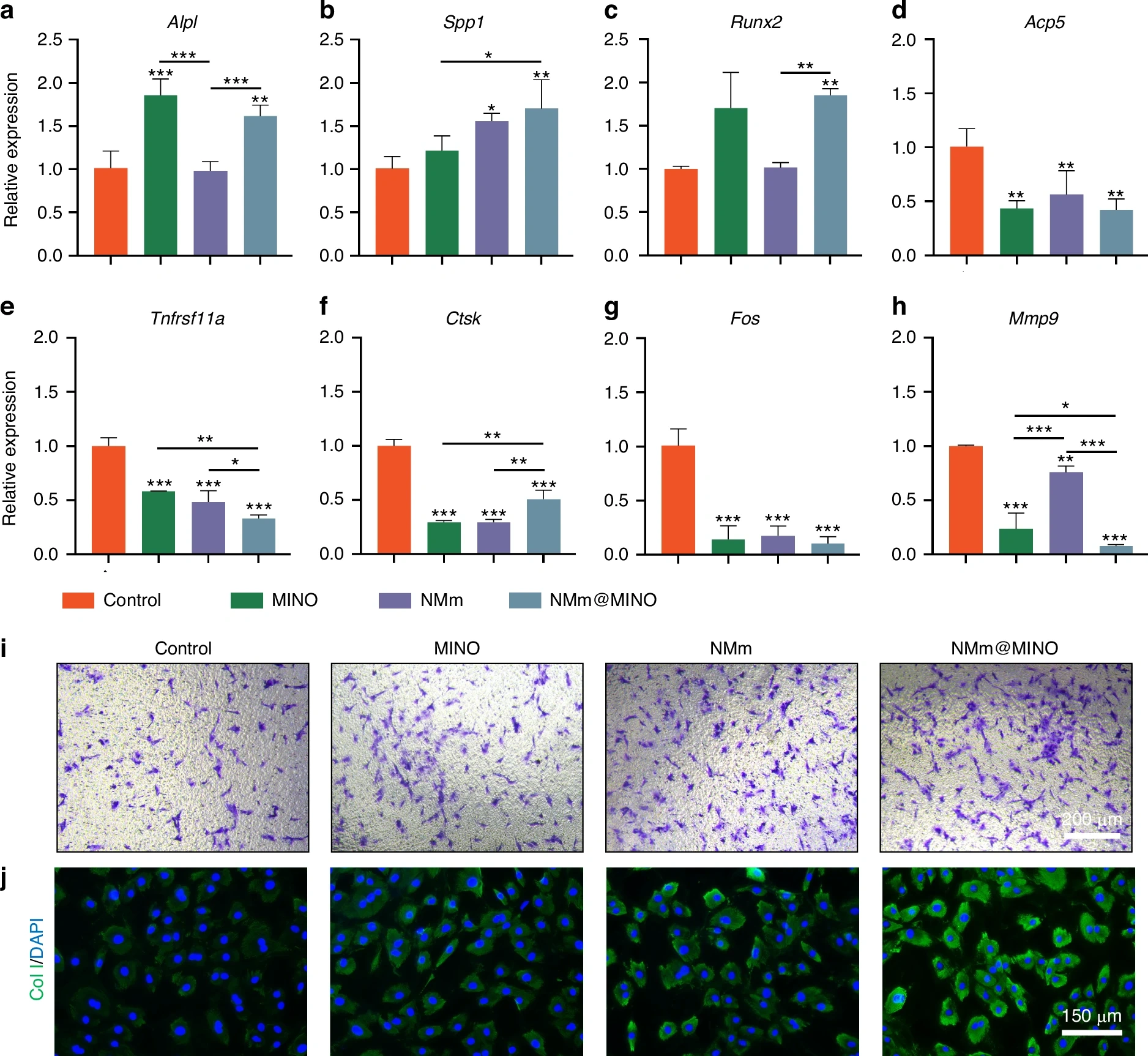 图源：A biomimetic nanoparticle coordinates antibacterial and immunomodulatory functions to promote periodontal regeneration