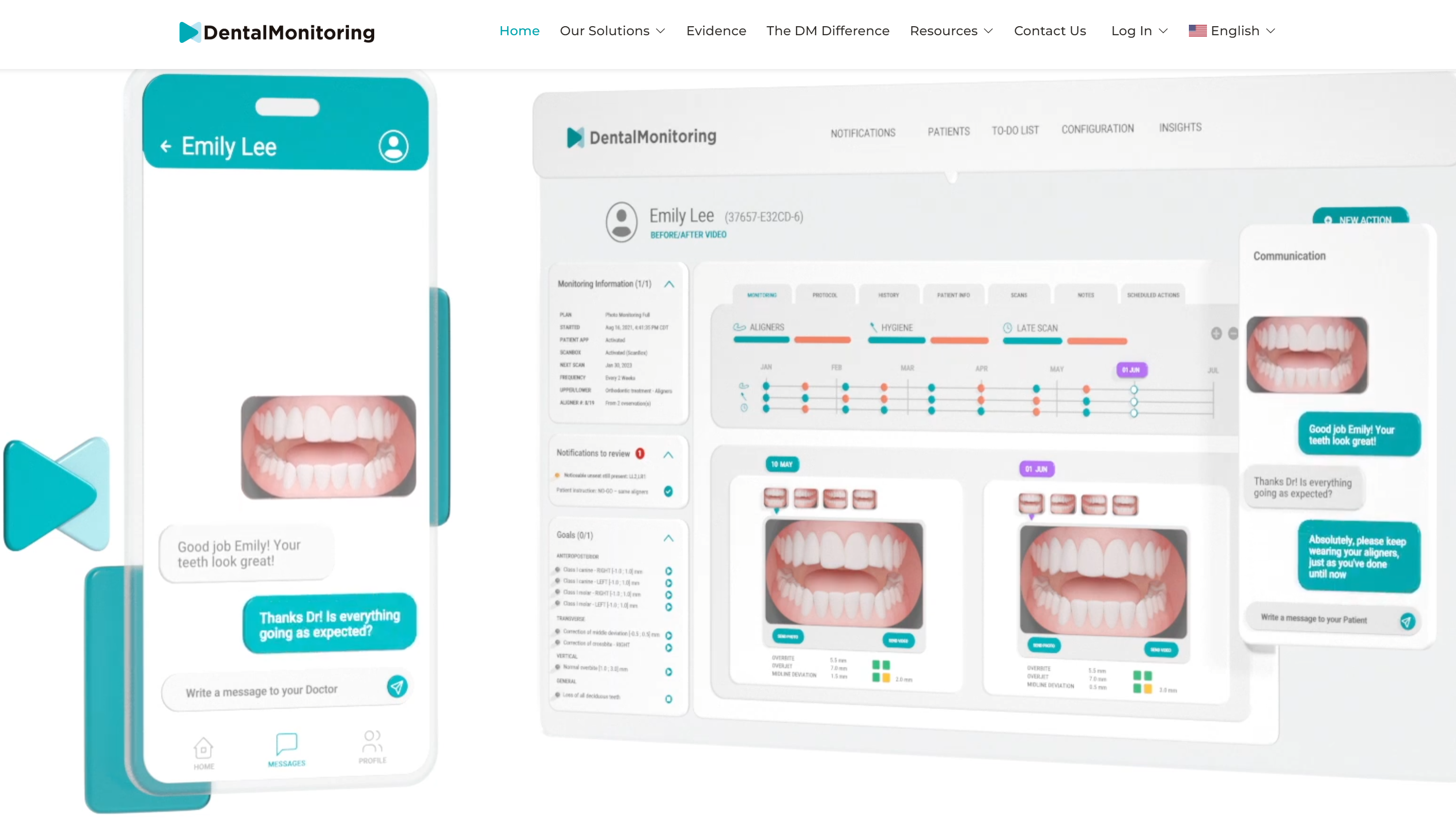 Image source: DentalMonitoring official website