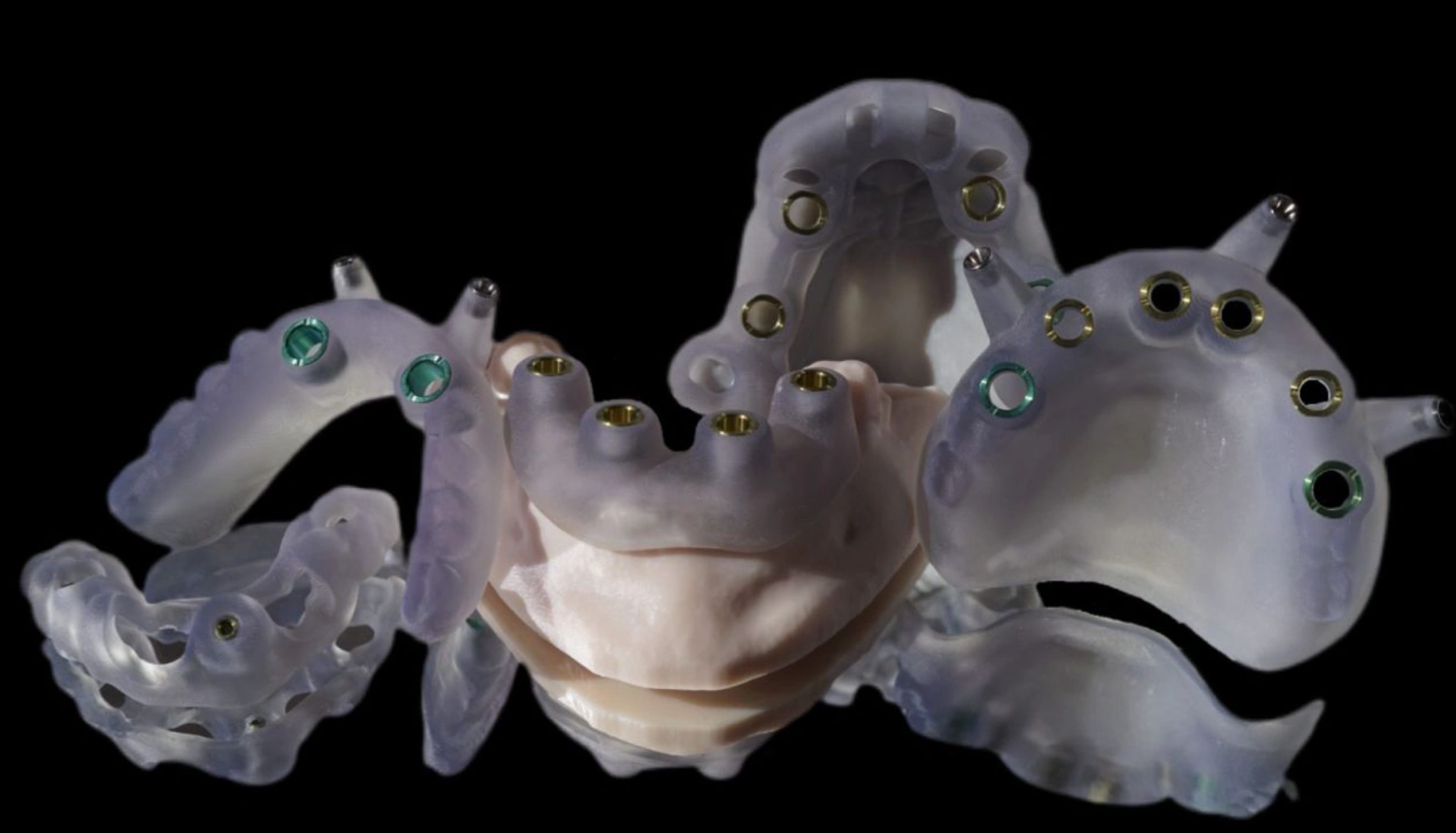 Image Source: Apex Dental Laboratory Group