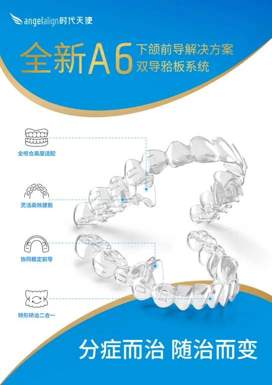 New A6 Mandibular Advancement Solution – A6 Dual-Guide Splint System