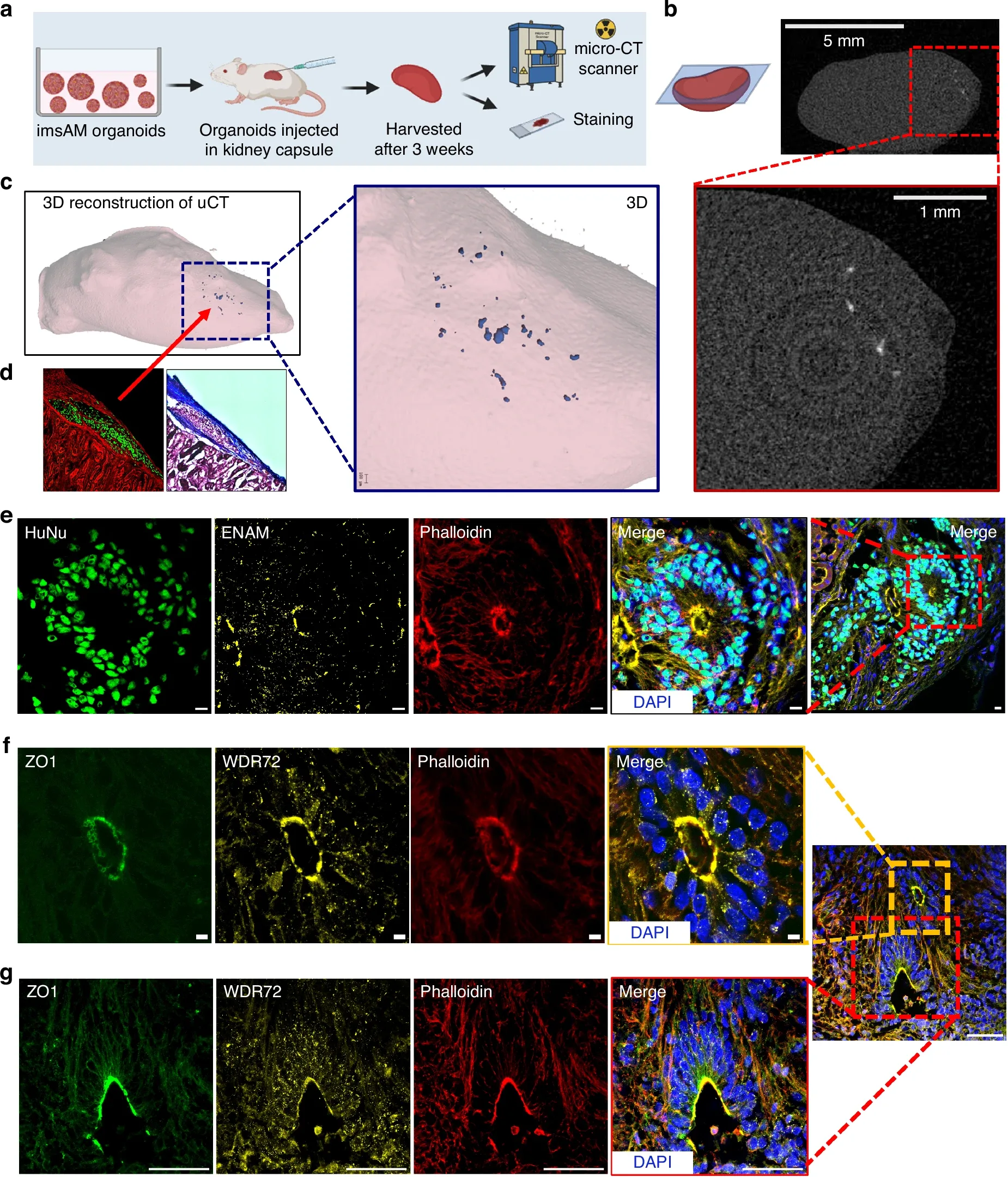 Source: Soluble Notch agonist enables human ameloblast maturation and enamel-like tissue formation for tooth regeneration