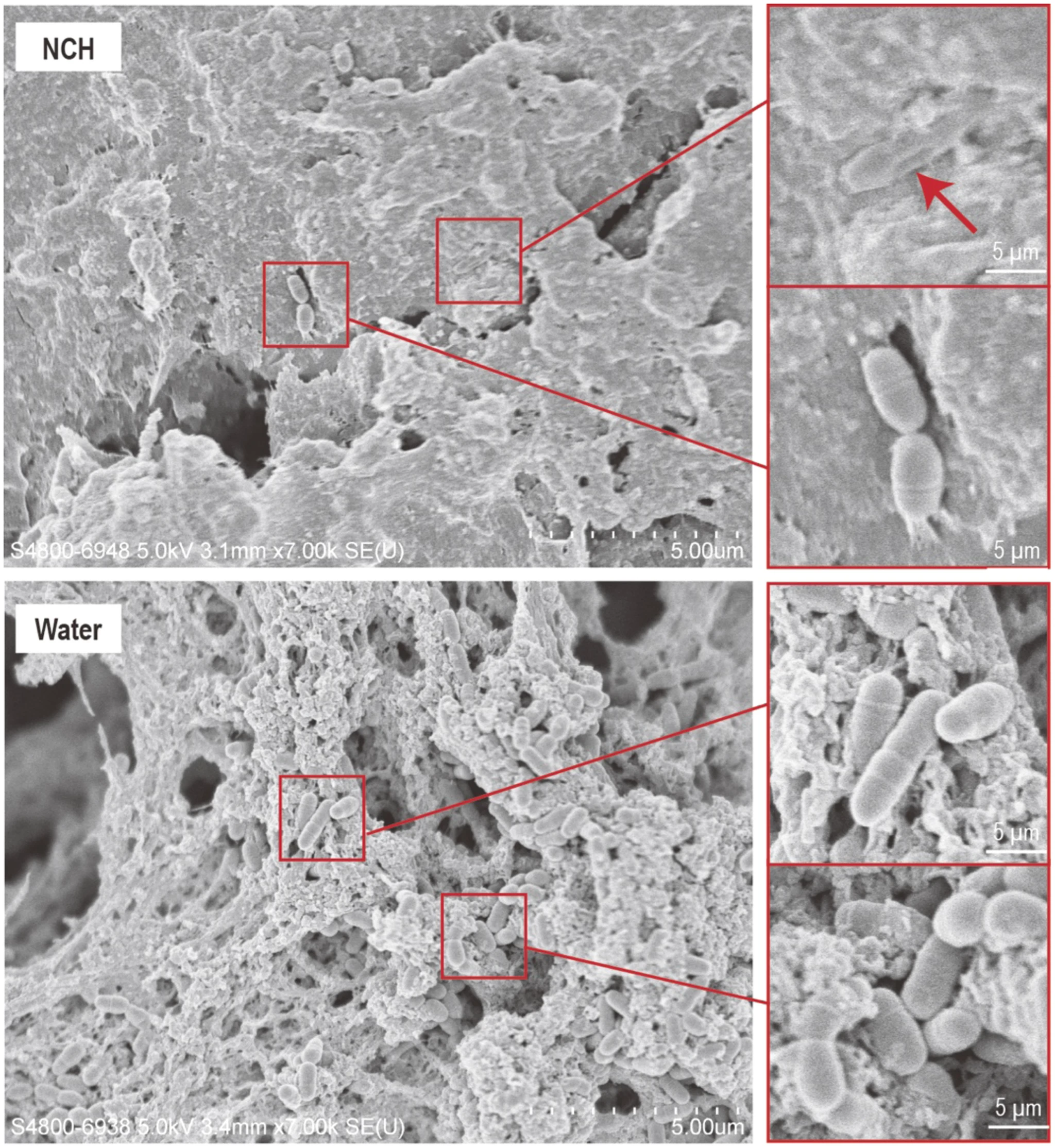 Source: Development of a novel pH-responsive anti-caries nanocomposite hydrogel