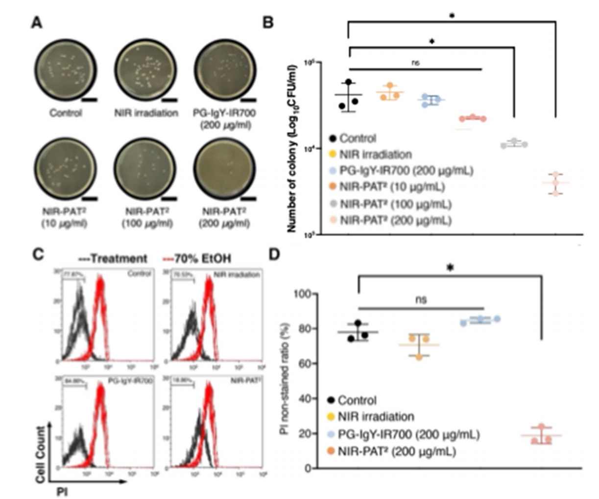 Image source: Near infrared photo-bacterial flora modulation technology realized controlling periodontitis: modulation of disease-associated dysbiosis in oral microbiota using near infrared photo-antibacterial targeting therapy (NIR-PAT2)