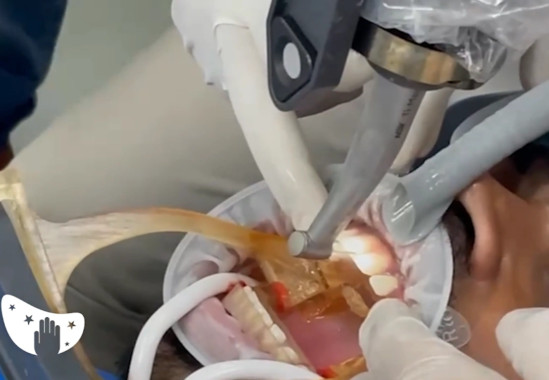 Image source: Lupin Dental SAS official website