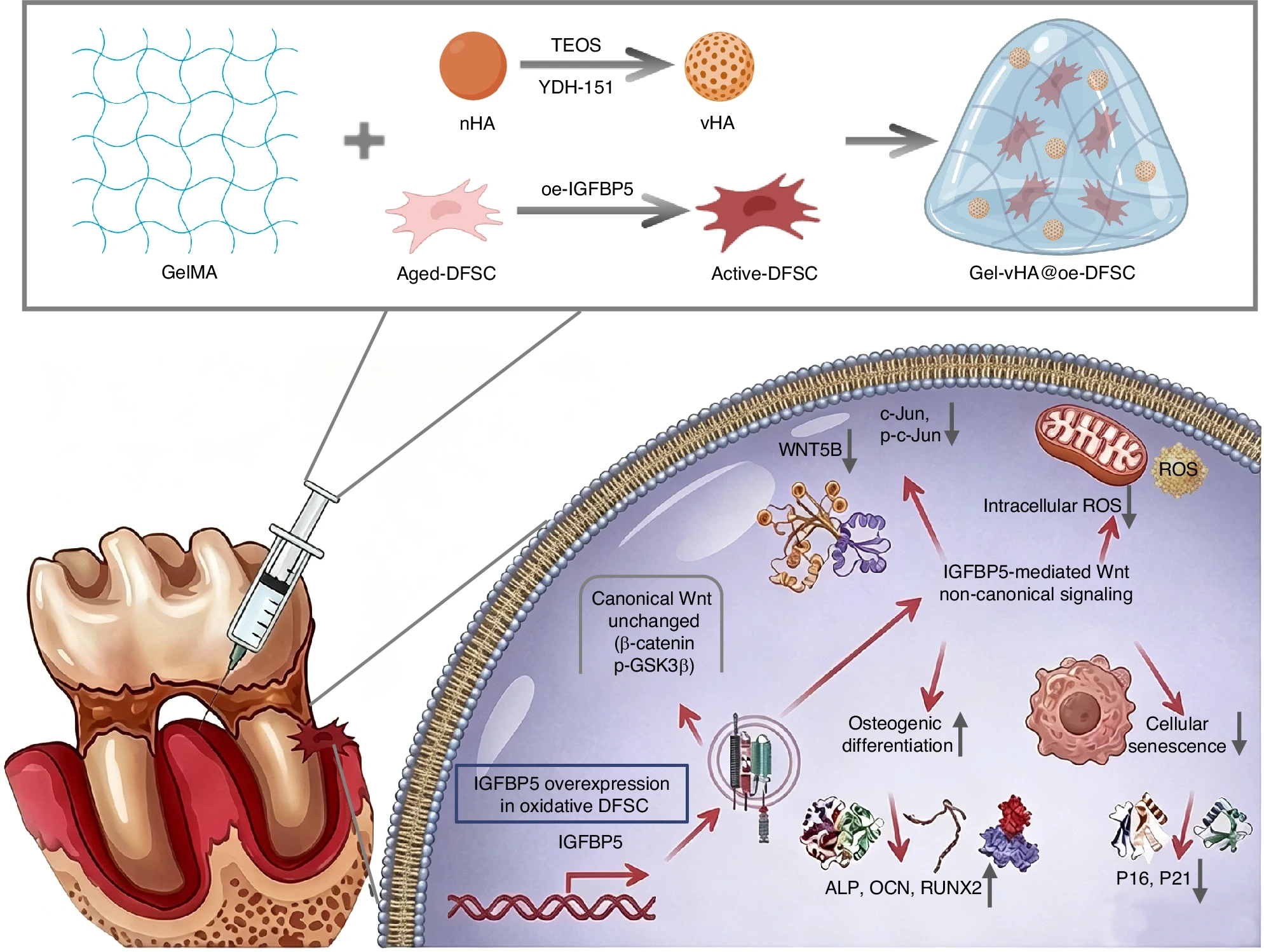 Source: IGFBP5 alleviates periodontitis by reversing human dental follicle stem cell senescence via the non-canonical Wnt pathway