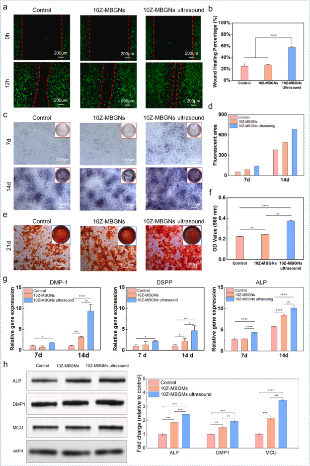 Source: Piezoelectric ZnO-incorporated bioactive glass nanospheres for enhanced odontogenic differentiation and angiogenesis