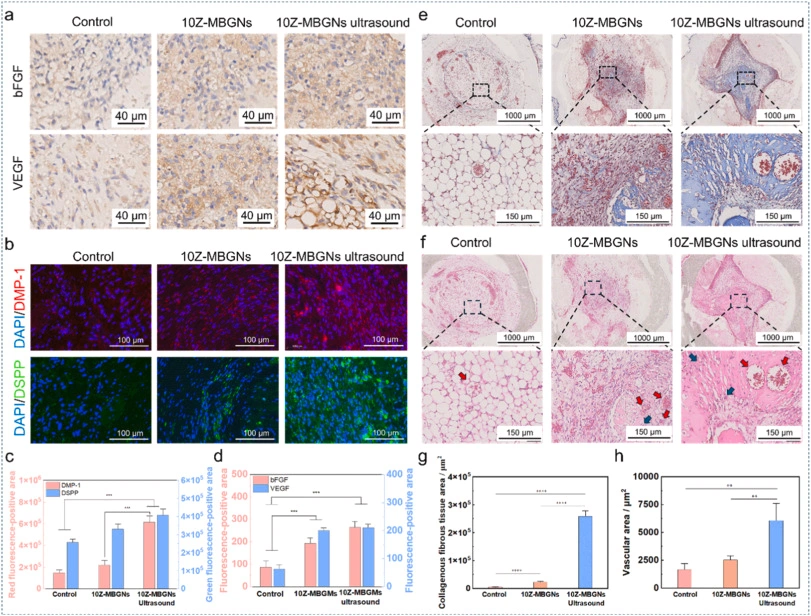 Source: Piezoelectric ZnO-incorporated bioactive glass nanospheres for enhanced odontogenic differentiation and angiogenesis