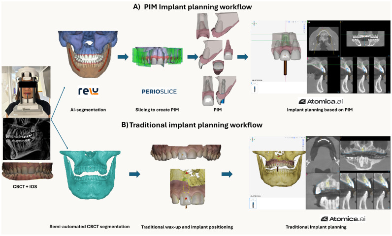 Source: A novel AI-assisted three-dimensional hard- and soft-tissue hybrid model for peri-implant diagnosis and treatment planning: a proof-of-concept study on immediate implant planning in the anterior region